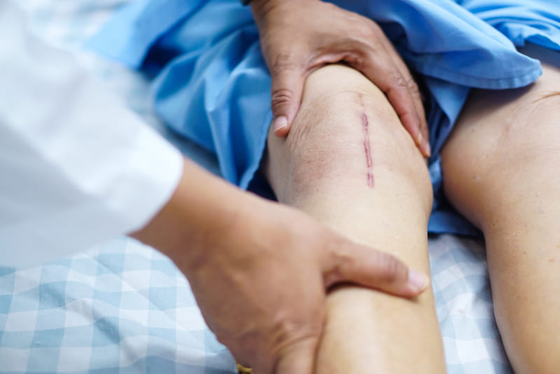 Special Skin Care and Recognizing Changes in Skin Condition