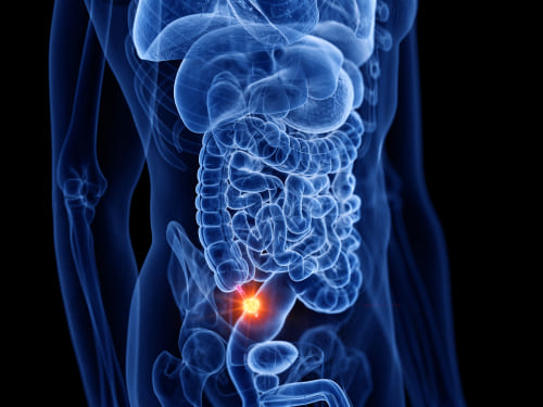 Parts of the Lymphatic and Immune Systems<