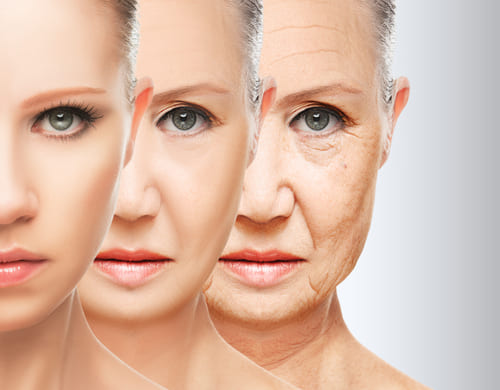What is Aging?<