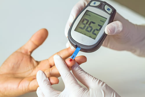 Capillary Blood Glucose<