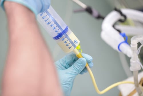 Feeding Tubes<