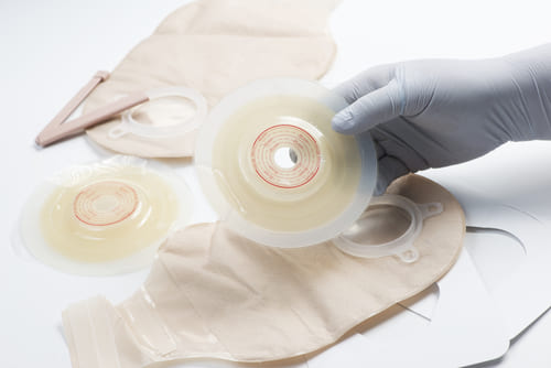 Basic Ostomy Care<